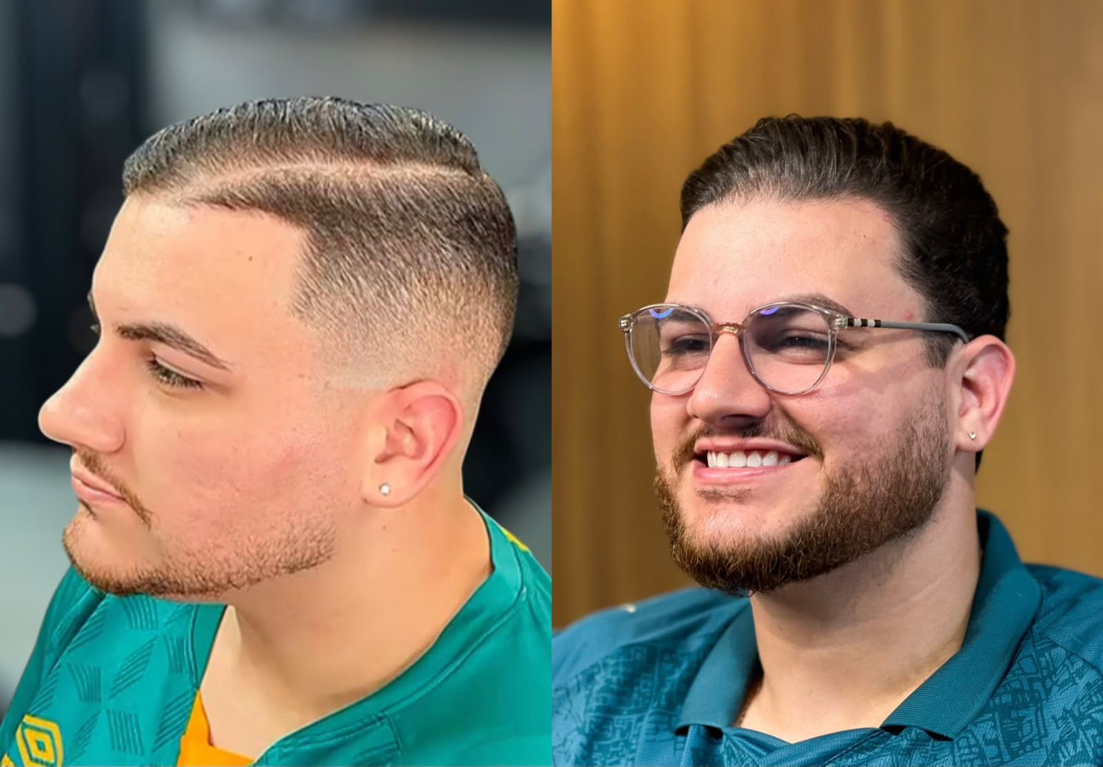 Antes e depois de visagismo no Mr. Jofley — resultado 2